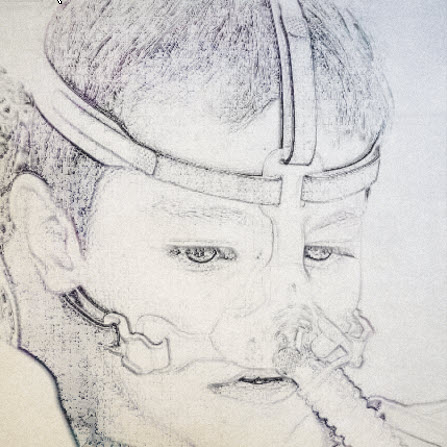 neusmasker