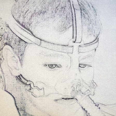 neusmasker